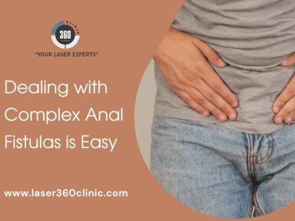 Dealing with Complex Anal Fistulas is Easy